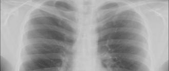 Characterization X-ray: description, action, features X-ray radiation Properties